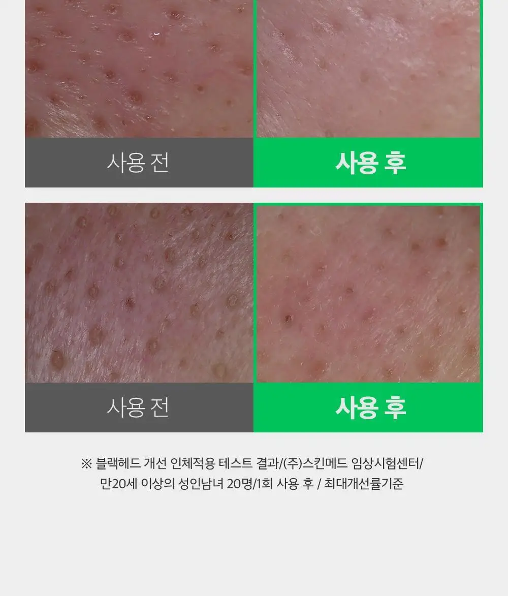 [말끔모공/블랙헤드] 성분에디터 그린토마토 모공 클렌징 오일 200ml 상세페이지 38